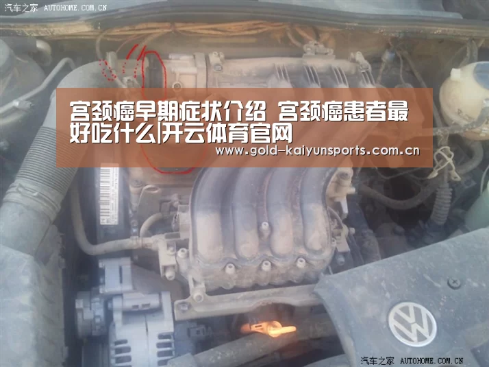 宫颈癌早期症状介绍 宫颈癌患者最好吃什么|开云体育官网(图3) 开云登录